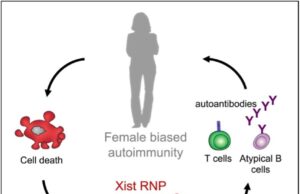 Sains yang Dapat Kita Manfaatkan: Mengapa Gangguan Autoimun Lebih Sering Menimpa Wanita Dibandingkan Pria?