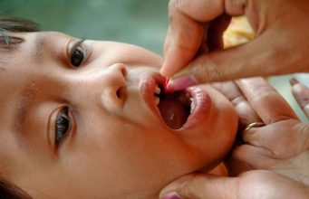 Cegah Risiko dan Komplikasi Cacar Air pada Anak dengan Imunisasi