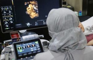 Fertilisasi Sel Telur dan Sperma serta Kondisi Janin saat Hamil