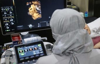 Fertilisasi Sel Telur dan Sperma serta Kondisi Janin saat Hamil