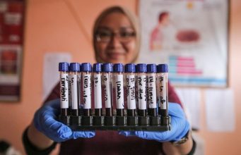 Menkes Pemerataan Labkesmas Hingga Level Puskesmas Bisa untuk Deteksi TBC hingga HIV