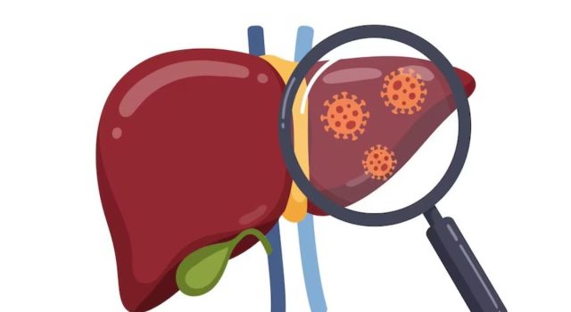 Tanpa Gejala Awal, Hepatitis Kronis Berisiko Fatal bagi Hati